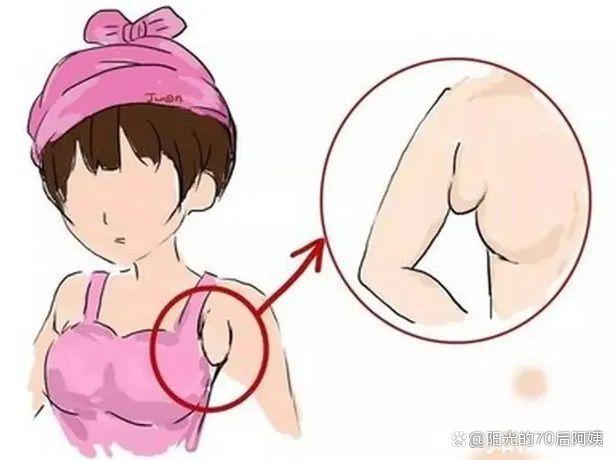 狐臭 腋臭 腋下出汗 汗腺 青春期腋臭 女性腋臭 男性腋.