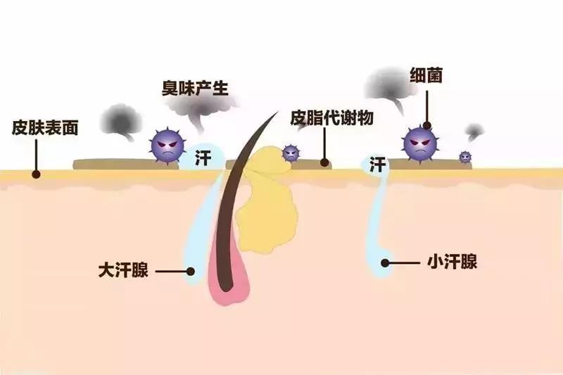 狐臭,医学上称为腋臭症,是由腋窝大汗腺分泌的有机物被细菌分解后产生