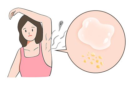 狐臭眼长什么样子图片_39健康网
