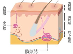 腋臭会遗传吗