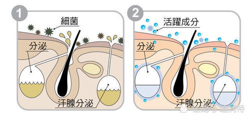 狐臭是怎么引起的 有狐臭怎么办呢
