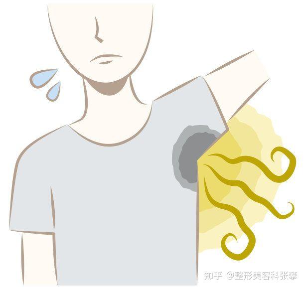 孩子身上有腋臭异味,应该怎么办,好像是遗传的? - 