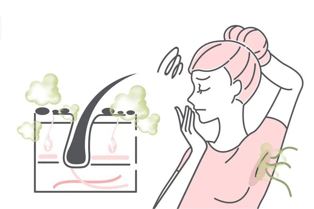 如何拯救令人尴尬和苦恼的狐臭?(内含解决之道)_患者_汗腺_腋臭